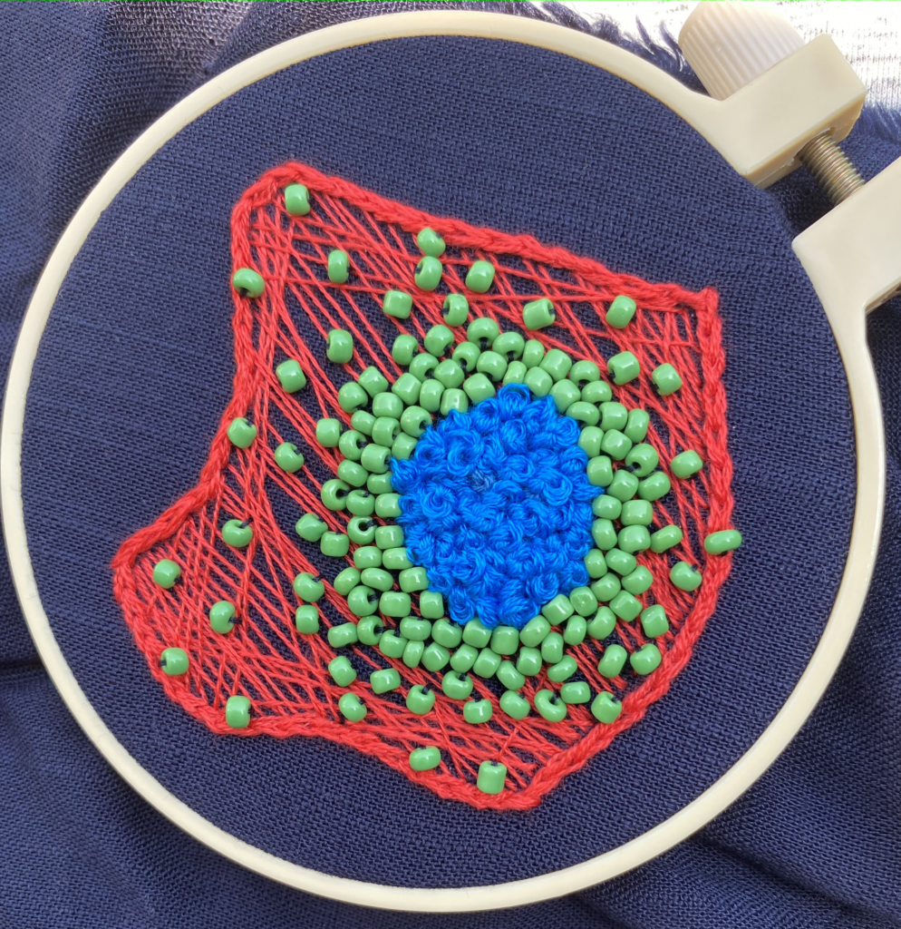 Embroidered cancer cell